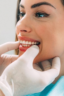 A dental professional holding a female patient’s mouth as they examine her smile