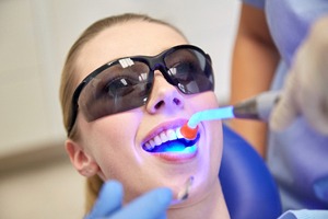 A curing light being used on a female patient’s tooth to harden the composite resin