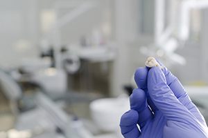 Dentist’s gloved hand holding tooth after simple extraction