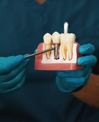 Dentist in teal scrubs pointing to sample implant with mirror handle