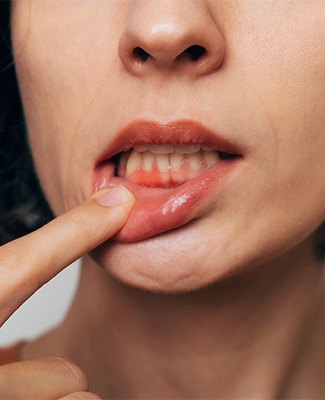 Woman pulling down gums to reveal gum disease